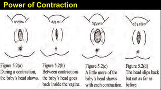 Power of Contraction
21
 