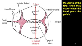 Moulding of the
fetal skull may
occur when the
head pass the
pelvis.
27
 