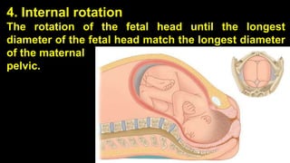 4. Internal rotation
The rotation of the fetal head until the longest
diameter of the fetal head match the longest diameter
of the maternal
pelvic.
30
 