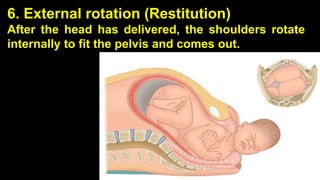 6. External rotation (Restitution)
After the head has delivered, the shoulders rotate
internally to fit the pelvis and comes out.
32
 