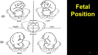 Fetal
Position
12
 