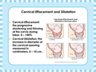 Cervical Effacement and Dilatation
➢ Cervical Effacement:
the progressive
shortening and thinning
of the cervix during
labor. 0 – 100%
➢ Cervical Dilatation: the
increase in diameter of
the cervical opening
measured in
centimeters. 0 – 10 cm.
 
