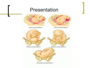 Labor-and-delivery.pdf
