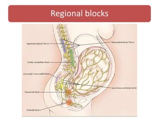 Regional blocks
 