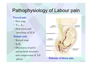 l
epidural T1O
-L1 _-4-_;
Low caudal or
true saddleblock --(,J._-
Sacral nerve-root
blocks S2-S4
Segmenta
Pathophysiology of Labour pain
Visceral pain
◦ First stage
◦ T10 - L1
◦ Distension and
stretching of LUS
Somatic pain
◦ Second stage
◦ S2-S4
◦ Distension of pelvic
and perinial structures
and compression of LS
Pathways of labour pain
plexus
 