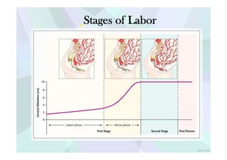 10
- 8
E
&
C:
0
6
"D
:!
nl
0 4
ij
~
? 2
C)
u
0
,._____ La ent phase - - - --. Active phase
First Stage Second Stage Post Partum
fpp com
~..I.
Stages of Labor
 