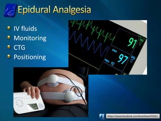 https://www.facebook.com/AnesthesiaTOOLS
IV fluids
Monitoring
CTG
Positioning
 