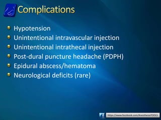 https://www.facebook.com/AnesthesiaTOOLS
Hypotension
Unintentional intravascular injection
Unintentional intrathecal injection
Post-dural puncture headache (PDPH)
Epidural abscess/hematoma
Neurological deficits (rare)
 