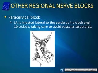 https://www.facebook.com/AnesthesiaTOOLS
Paracervical block
LA is injected lateral to the cervix at 4 o’clock and
10 o’clock, taking care to avoid vascular structures.
 