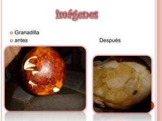  Granadilla
 antes Después
 