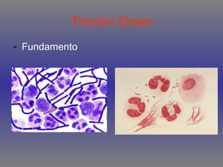 Tinción Gram
- Fundamento

 