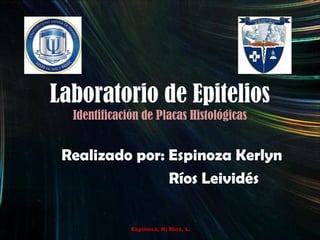 Laboratorio de Epitelios
Identificación de Placas Histológicas
Realizado por: Espinoza Kerlyn
Ríos Leividés
Espinosa, K; Ríos, L.
 