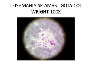 LEISHMANIA SP-AMASTIGOTA-COL
WRIGHT-100X
 