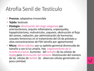 Atrofia Senil de Testículo
• Proceso: adaptativo irreversible
• Tejido: testículo
• Etiología: disminución del riego sanguíneo por
  arteriosclerosis, orquitis inflamatoria, criptorquidia,
  hipopituitarismo, malnutrición, caquexia, obstrucción al flujo
  del semen, radiación, por administración de hormonas
  sexuales femeninas en el tratamiento del CA de próstata y
  altas concentraciones de FSH (atrofia por agotamiento)
• Micro: afecta túbulos con su epitelio germinal disminuido de
  tamaño y con la luz amplia. Hay engrosamiento de la
  membrana basal. Aumento del tamaño de las células de
  leydig pero disminución del número. Disminución del número
  de las células de Sertoli. Se observan células germinales en
  poca cantidad.
 