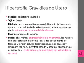 Hipertrofia Gravídica de Útero
• Proceso: adaptativo reversible
• Tejido: útero
• Etiología: incrementos fisiológicos del tamaño de las células
  de útero por la síntesis de más elementos estructurales esto
  por la estimulación hormonal del embarazo
• Macro: aumento de tamaño
• Micro: observamos engrosamiento del miométrio, los núcleos
  celulares están ampliamente separados por aumento del
  tamaño y función celular (leiomiocitos, células gruesas y
  alargadas con núcleo central, grande y basófilo, el citoplasma
  es acidófilo; el endometrio está engrosado con vellosidades
  coreales
 