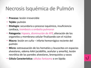 Necrosis Isquémica de Pulmón
• Proceso: lesión irreversible
• Tejido: pulmón
• Etiología: secundaria a proceso isquémico, insuficiencia
  cardiaca, trombosis o embolia pulmonar
• Patogenia: hipoxia, disminución de ATP, alteración de los
  organelos y membrana celular finalizando con el núcleo
• Macro: lesión en cuña – infarto hemorrágico reciente del
  pulmón
• Micro: extravasación de los hematíes y leucocitos en espacios
  alveolares, edema AAA (acidófilo, acelular y amorfo), lesión
  necrótica de las paredes alveolares, bronquiolos y vasos
• Célula Característica: células fantasma o en lápida
 
