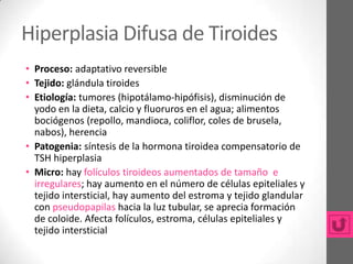 Hiperplasia Difusa de Tiroides
• Proceso: adaptativo reversible
• Tejido: glándula tiroides
• Etiología: tumores (hipotálamo-hipófisis), disminución de
  yodo en la dieta, calcio y fluoruros en el agua; alimentos
  bociógenos (repollo, mandioca, coliflor, coles de brusela,
  nabos), herencia
• Patogenia: síntesis de la hormona tiroidea compensatorio de
  TSH hiperplasia
• Micro: hay folículos tiroideos aumentados de tamaño e
  irregulares; hay aumento en el número de células epiteliales y
  tejido intersticial, hay aumento del estroma y tejido glandular
  con pseudopapilas hacia la luz tubular, se aprecia formación
  de coloide. Afecta folículos, estroma, células epiteliales y
  tejido intersticial
 