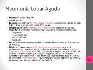Neumonía Lobar Aguda
• Proceso: inflamación aguda
• Tejido: pulmón
• Etiología: infección por H. Influenza o S. Pneumonie, este último con los subtipos
  1,3,7 y 2, de los cuales el 3 es el más virulento
• Patogenia: la bacteria entra por vía respiratoria y se depositan en las vías
  respiratorias terminales y alvéolos. Hay 4 fases en la respuesta inflamatoria:
   •   Congestión
   •   Hepatización roja
   •   Hepatización gris
   •   Resolución
• Macro: lóbulo pulmonar consolidado, aumento de peso, color grisáceo y zonas
  de abscesos
• Micro: se observa una transición del parénquima pulmonar, una zona
  relativamente conservada y una zona de marcada condensación con alvéolos
  llenos de células inflamatorias. Así como también una gran cantidad de infiltrado
  inflamatorio intra-alveolar y la marcada congestión vascular. A un mayor
  aumento se puede observar el tipo de infiltrado dentro de los alvéolos: se trata
  de leucocitos polimorfonuclares. Hay congestión vascular, depósitos de fibrina y
  descamación de células epiteliales (neumocitos)
 