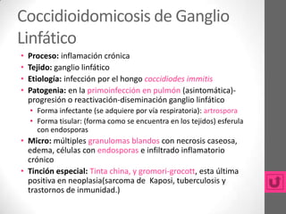 Coccidioidomicosis de Ganglio
Linfático
•   Proceso: inflamación crónica
•   Tejido: ganglio linfático
•   Etiología: infección por el hongo coccidiodes immitis
•   Patogenia: en la primoinfección en pulmón (asintomática)-
    progresión o reactivación-diseminación ganglio linfático
    • Forma infectante (se adquiere por vía respiratoria): artrospora
    • Forma tisular: (forma como se encuentra en los tejidos) esferula
      con endosporas
• Micro: múltiples granulomas blandos con necrosis caseosa,
  edema, células con endosporas e infiltrado inflamatorio
  crónico
• Tinción especial: Tinta china, y gromori-grocott, esta última
  positiva en neoplasia(sarcoma de Kaposi, tuberculosis y
  trastornos de inmunidad.)
 