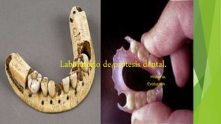Laboratorio de prótesis dental.
Historia.
Evolución.
 