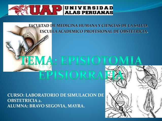 Laboratorio episiotomia y episiorrafia (1) | PPT