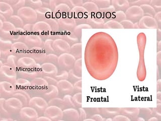 Laboratorio hematologico anemias leucemias | PPSX