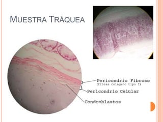 MUESTRA TRÁQUEA
(fibras colágeno tipo I)
 