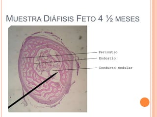 MUESTRA DIÁFISIS FETO 4 ½ MESES
Endostio
Periostio
Conducto medular
 