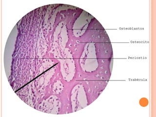 Osteoblastos
Osteocito
Trabécula
Periostio
 
