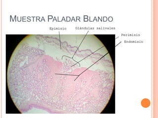 MUESTRA PALADAR BLANDO
Glándulas salivalesEpimisio
Perimisio
Endomisio
 