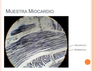 MUESTRA MIOCARDIO
Perimisio
Endomisio
 