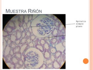 MUESTRA RIÑÓN
Epitelio
simple
plano
 