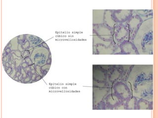 Epitelio simple
cúbico sin
microvellosidades
Epitelio simple
cúbico con
microvellosidades
 