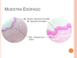 MUESTRA ESÓFAGO
 