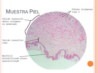Tejido conectivo
laxo
Tejido conectivo
denso colágeno
no modelado
Epitelio
estratificado plano
queratinizado
Fibras colágenas
tipo IMUESTRA PIEL
 