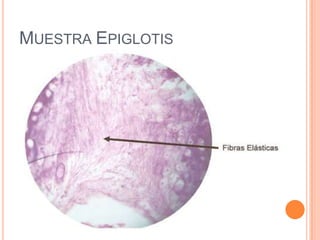 MUESTRA EPIGLOTIS
 