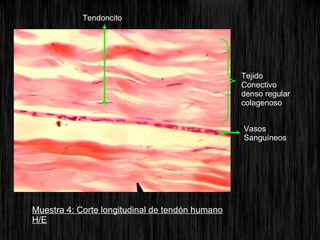 Muestra 4: Corte longitudinal de tendón humano H/E Tendoncito Tejido Conectivo denso regular colagenoso Vasos Sanguíneos 