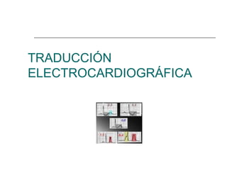 TRADUCCIÓN
ELECTROCARDIOGRÁFICA
 