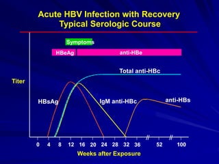 Acute HBV Infection with Recovery
Typical Serologic Course
Weeks after Exposure
Titer
Symptoms
HBeAg anti-HBe
Total anti-HBc
IgM anti-HBc anti-HBs
HBsAg
0 4 8 12 16 20 24 28 32 36 52 100
 