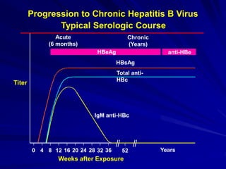 Progression to Chronic Hepatitis B Virus
Typical Serologic Course
Weeks after Exposure
Titer
IgM anti-HBc
Total anti-
HBc
HBsAg
Acute
(6 months)
HBeAg
Chronic
(Years)
anti-HBe
0 4 8 12 16 20 24 28 32 36 52 Years
 