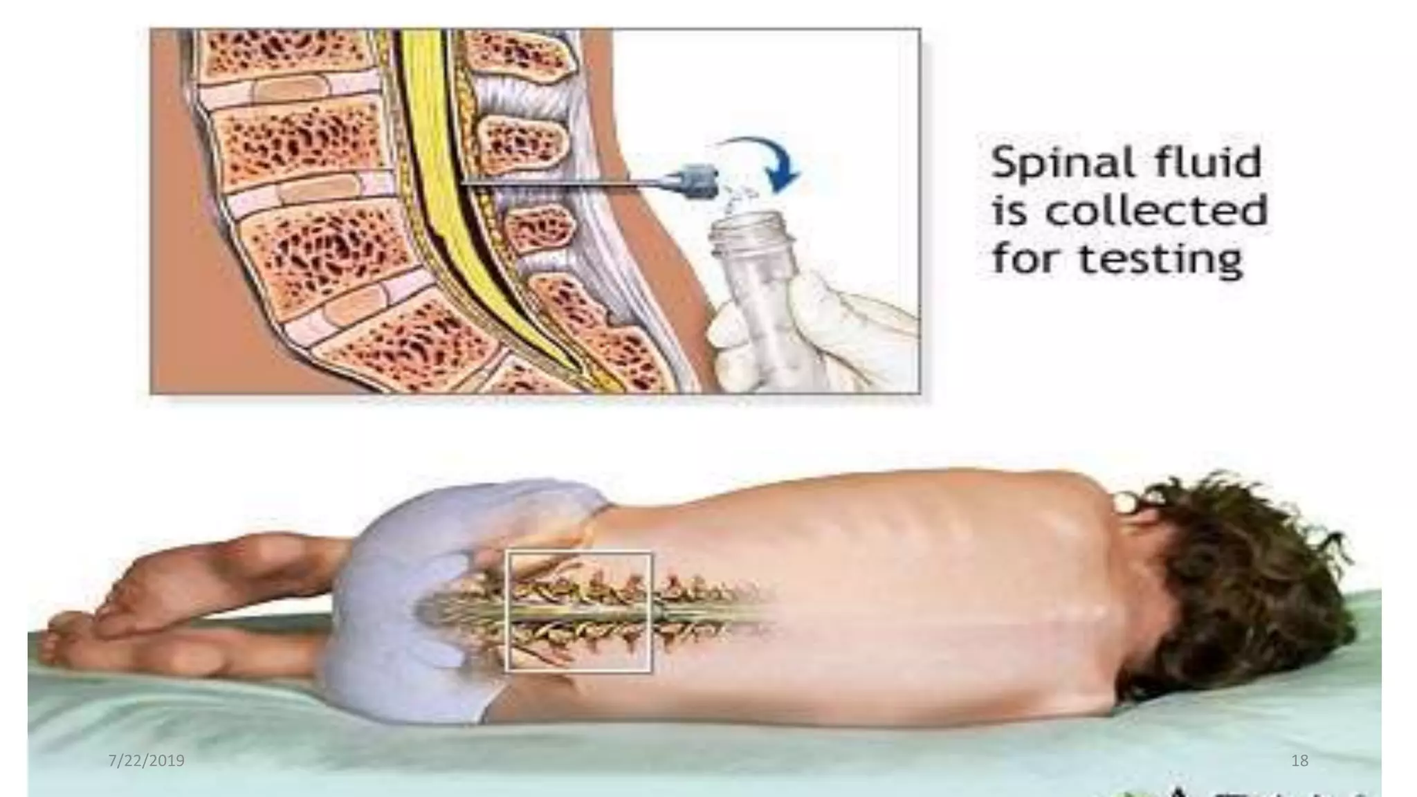 fddf
•vdfd
7/22/2019 18
 