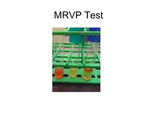 Laboratory Biochemical Assays Mcb1010 L | PPT