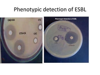 Laboratory detection of resistant bacteria | PPTX