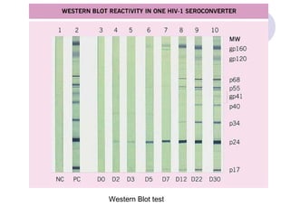 Laboratory diagnosis of HIV | PPT