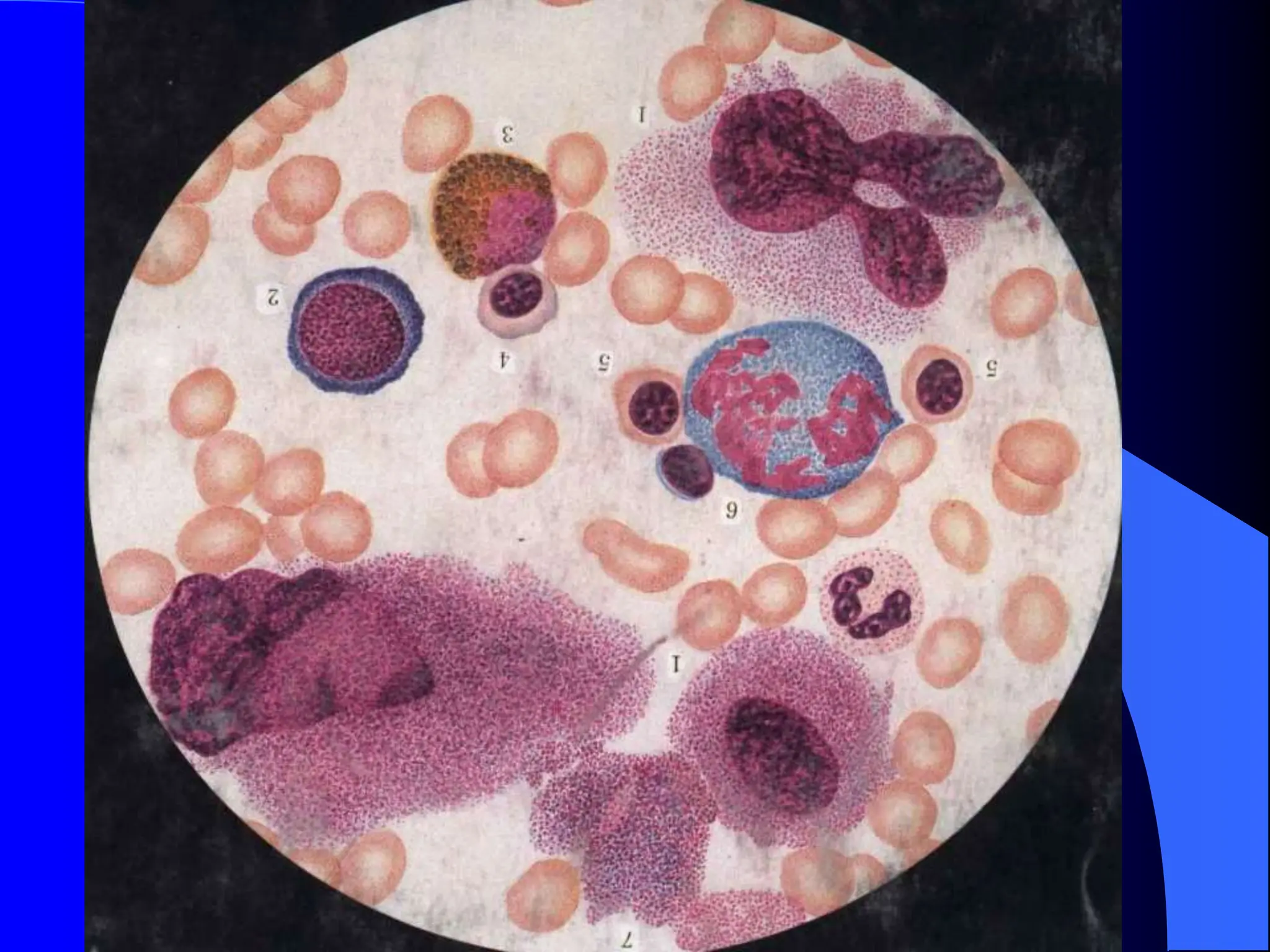 Laboratory diagnosis.ppt and clincal diagnosis