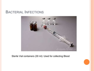 BACTERIAL INFECTIONS
Sterile Vial containers (30 ml): Used for collecting Blood
 