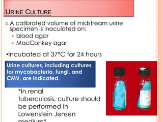 URINE CULTURE
 A calibrated volume of midstream urine
specimen is inoculated on:
 blood agar
 MacConkey agar
•Incubated at 37ºC for 24 hours
*In renal
tuberculosis, culture should
be performed in
Lowenstein Jensen
Urine cultures, including cultures
for mycobacteria, fungi, and
CMV, are indicated.
 