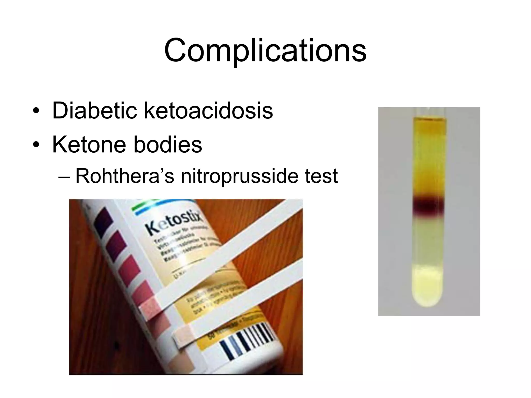 Complications
• Diabetic ketoacidosis
• Ketone bodies
– Rohthera’s nitroprusside test