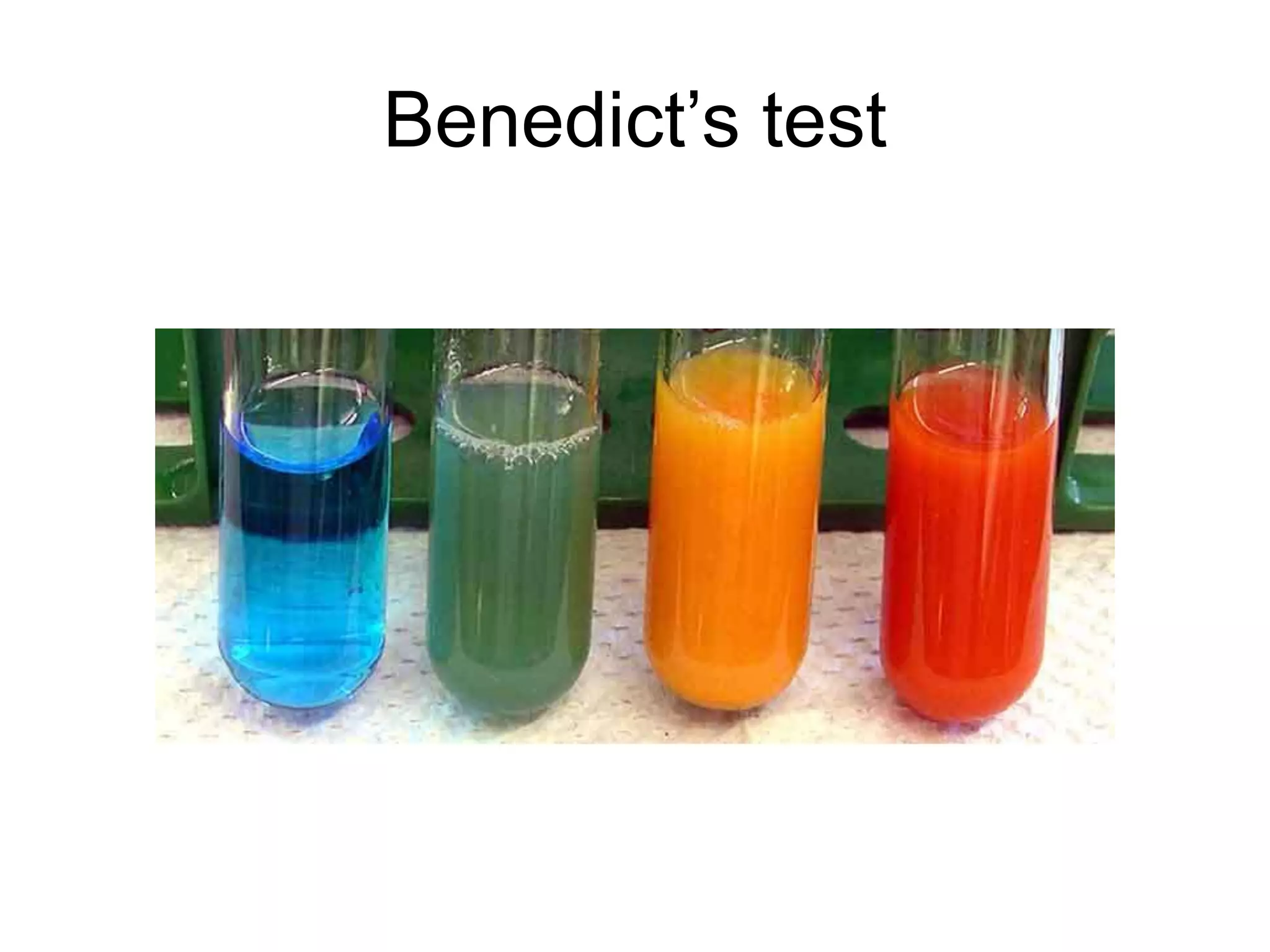 Benedict’s test
