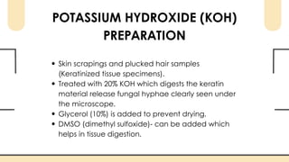 Koh Tablet Method Laboratory Diagnosis of Fungal Infections | PDF